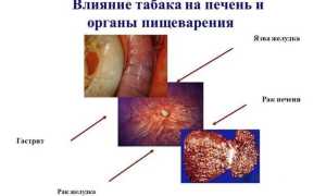 Можно ли курить при гастрите – воздействие на желудок