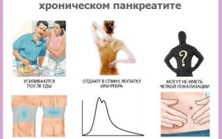 Панкреатит острый и хронический, симптомы, диета при панкреатите, лечение