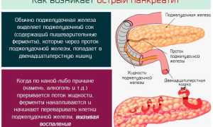 Куркума при панкреатите поджелудочной железы – можно или нет