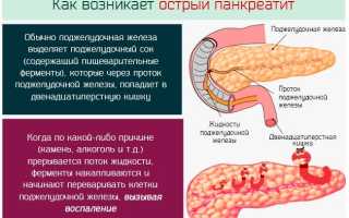 Куркума при панкреатите поджелудочной железы – можно или нет