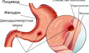 Омез (Omez) описание препарата: инструкция по применению, цена, противопоказания, состав, аналоги, отзывы