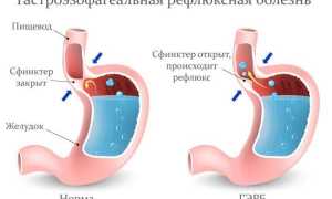 Во рту горечь и сухость причины и лечение, по утрам подробная информация