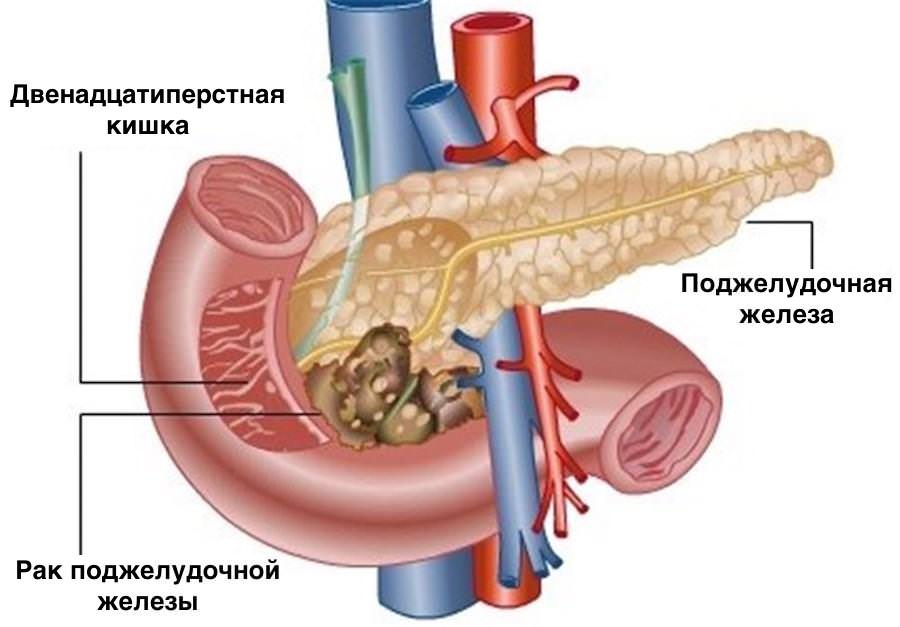 Заболевание
