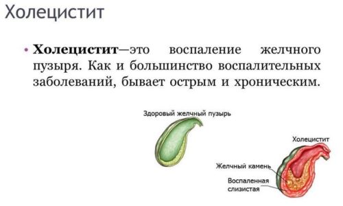 Воспалительные процессы при холецистите и панкреатите могут лечиться продуктами пчеловодства