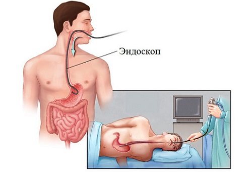 ФГДС
