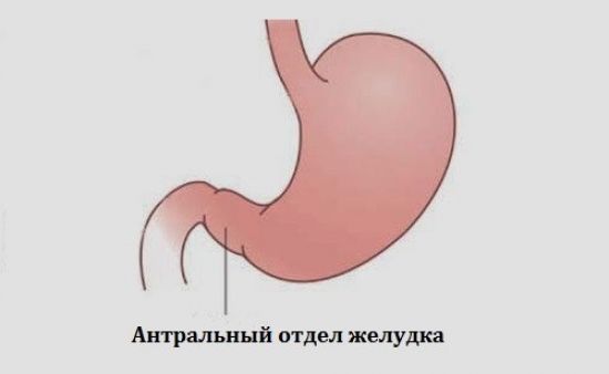 Антральный отдел желудка