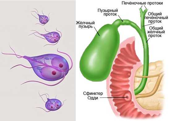 Паразиты в желчном пузыре