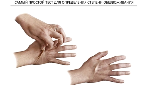 Если складка кожи разглаживается сразу - все нормально. Если же складка сохраняется и не раглаживается даже маленький промежуток времени - воды в организме не хватает.