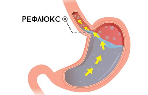 РЕФЛЮКС