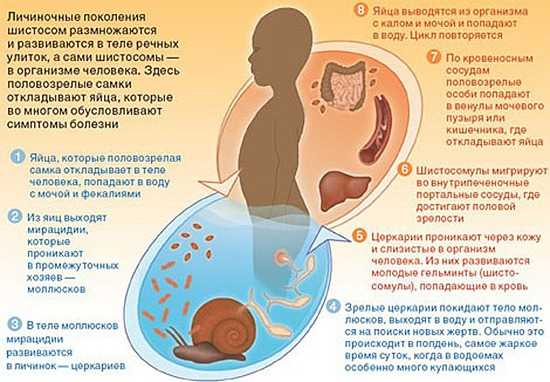 Шистосомоз цикл развития