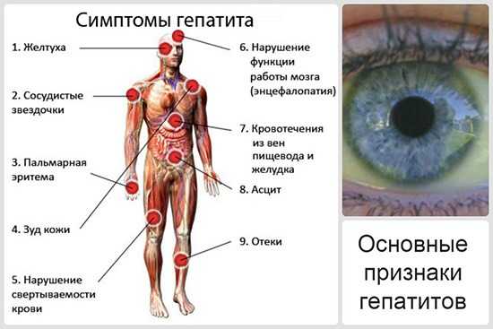 Симптомы воспаления печени