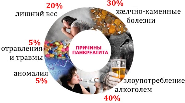 Симптомы боли поджелудочной железы. Признаки панкреатита, лечение поджелудочной железы