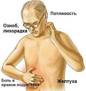 Симптомы эмпиемы желчного пузыря