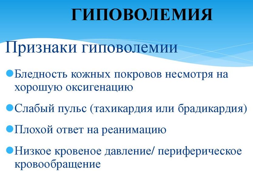 Гиповолемия