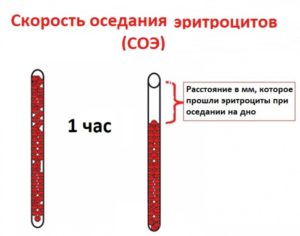 СОЭ 