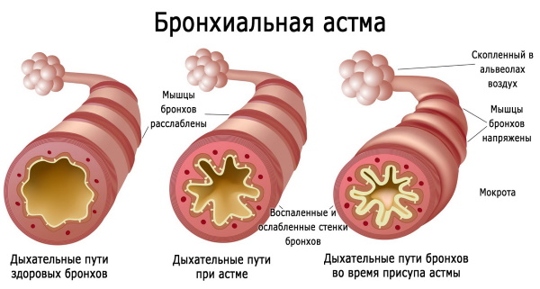 Винилин (бальзам Шостаковского). Инструкция по применению, цена, отзывы, аналоги