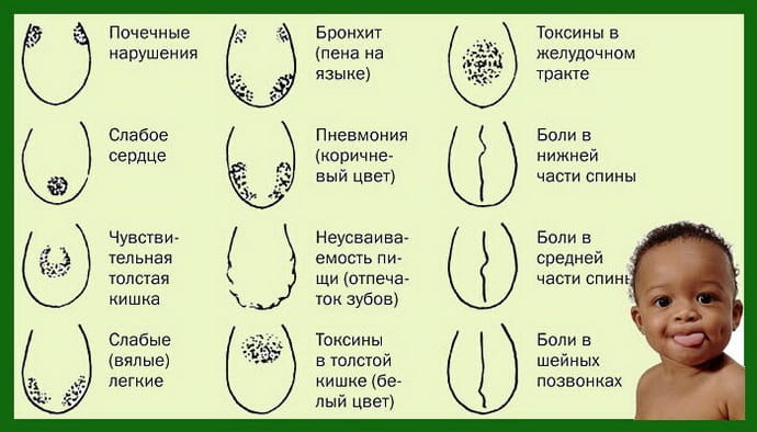 Характеристики языка при болезнях