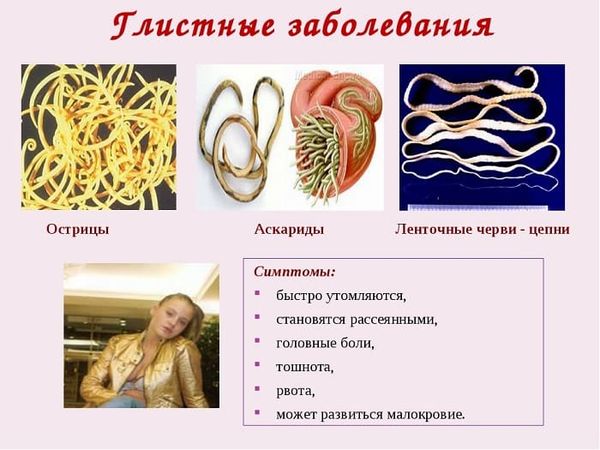 Глистные заболевания у человека